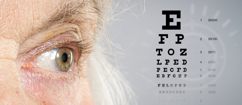 eye doctor checkup concept