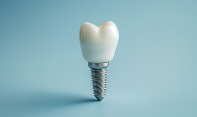 Model of Dental implants with a pin on a blue background. Medicine concept, World Oral Health Day