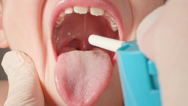 The doctor treats the child's throat by spraying medicine. close-up