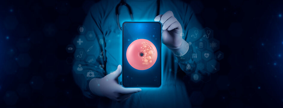 Image of the inside of the uterus on the doctor's tablet. The gynecologist analyzes the area of the cervix with cellular tissue damaged by cancer. Concept of modern technology to combat cervical cance