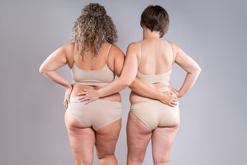 Two overweight women with cellulitis, fat flabby back, hips and buttocks on gray background, obese female body, liposuction, plastic surgery and body positive concept - 785049384