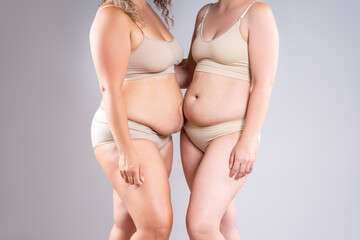 Two overweight women with cellulitis, fat flabby bellies, legs, hands, hips and buttocks on gray background, obese female body, liposuction and plastic surgery concept - 785049503