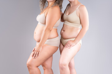 Two overweight women with cellulitis, fat flabby bellies, legs, hands, hips and buttocks on gray background, obese female body, liposuction and plastic surgery concept - 785049507