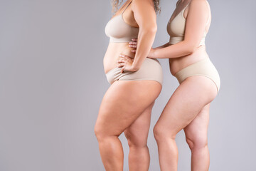 Two overweight women with cellulitis, fat flabby bellies, legs, hands, hips and buttocks on gray background, obese female body, liposuction and plastic surgery concept - 785049521