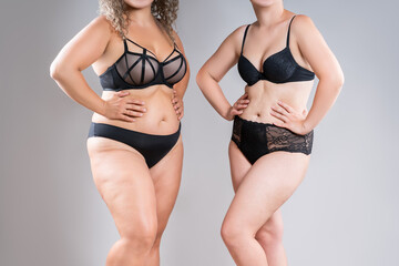 Tummy tuck, two overweight fat women with cellulitis and flabby bellies on gray background, obese female body, liposuction and plastic surgery concept