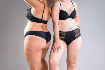 Two overweight women with cellulitis, fat flabby bellies, legs, hands, hips and buttocks on gray...