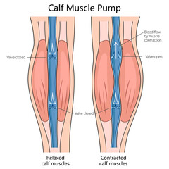 blood flow in relaxed and contracted calf muscles, indicating valve positions and muscle states structure diagram hand drawn schematic raster illustration. Medical science educational illustration © Oleksandr Pokusai