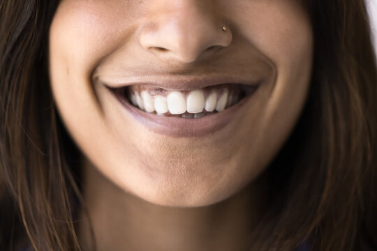 Toothy smile close up of happy young Indian woman. Lower face of 20s girl, female dentist patient showing healthy white teeth, promoting dental care, enamel whitening, bleaching. Cropped shot