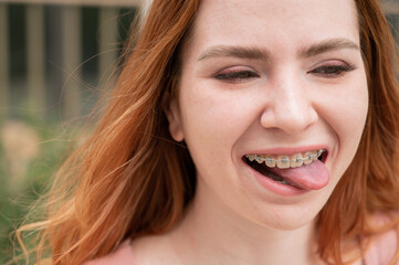 Young woman with braces on her teeth smiles and shows her tongue outdoors. 