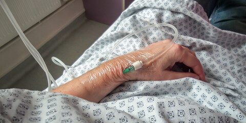 Close up on perfusion tube on a hand in an hospital - 785445943