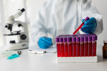 Hospital doctor holds blood vessel test in laboratory with blood sample from shelf with analyzer in...