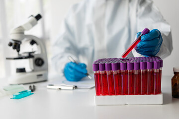 Hospital doctor holds blood vessel test in laboratory with blood sample from shelf with analyzer in lab