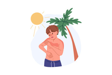 Boy received sunburn due to ultraviolet allergy or heliophobia, standing on beach with palm tree. Lack of sunscreen caused sunburn in child requiring medical attention or medicinal ointment