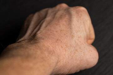 Fototapeta premium part of a man's hand with freckles