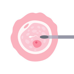 Intracytoplasmic sperm injection (ICSI). Intracytoplasmic sperm injection, ICSI, as part of IVF process - 785744199