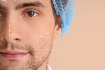 Handsome man with marked face on beige background, closeup. Plastic surgery concept
