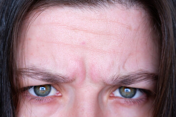 close-up of a woman's face with a wrinkled forehead. the woman wrinkles her forehead. facial wrinkles and creases