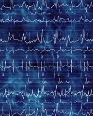 Blue EKG pattern with a white background. - obrazy, fototapety, plakaty
