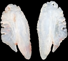 otohith of perch, these species have particularly large otohithts, statoconium or otoconium or statolith, is a calcium carbonate structure in the saccule or utricle of the inner ear