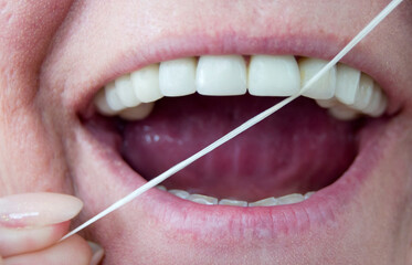 Closeup woman flossing perfect white teeth with floss toothcare hygiene.Teeth cleaning routine and...
