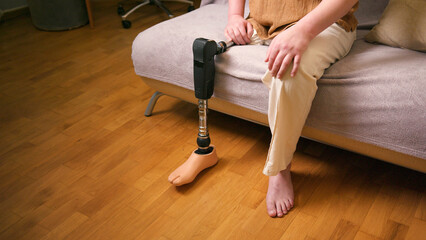 Close up of man amputee with prosthetic leg disability on above knee transfemoral leg prosthesis...