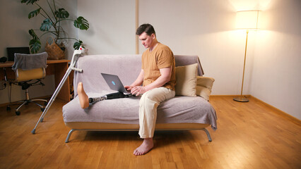 Man amputee with prosthetic leg disability on above knee transfemoral leg prosthesis artificial device using laptop at home. People with amputation disabilities everyday life