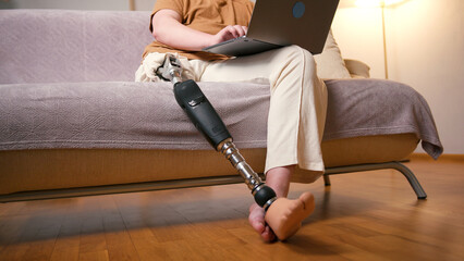 Man amputee with prosthetic leg disability on above knee transfemoral leg prosthesis artificial device using laptop at home. People with amputation disabilities everyday life - obrazy, fototapety, plakaty