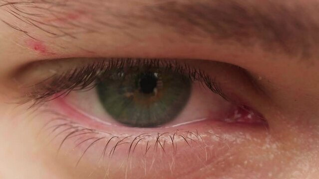 Male eye with beautiful green Iris Macro Shot. Close Up opening inflamed human eyes natural 