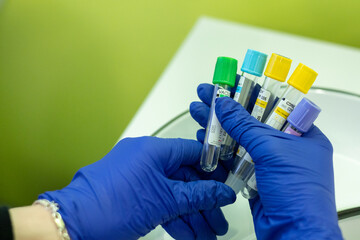 A nurse in blue gloves holds test tubes. Treatment in hospital. Various test tubes for sample...