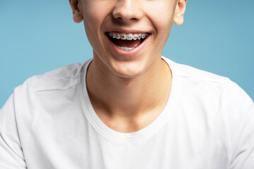 Excited, smiling boy with orthodontic braces, open mouth standing isolated on blue background