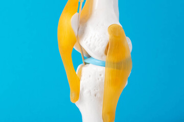 Medical mockup of the knee joint on a blue background, close-up. Concept of knee treatment with arthroscopic surgery. Knee replacement. - 787160925