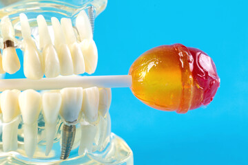 Candy on a stick in a tooth jaw mockup on a blue background. Concept of the effect of candies and sweets on the oral cavity and tooth enamel. Tooth destruction by sweet bacteria. 