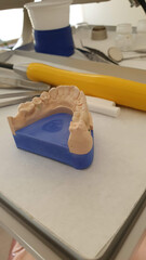 Kieferabdruck für Zahnprothese: Dentales 3D-Modell