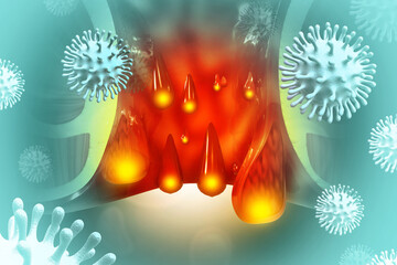 Haemorrhoids (piles) on scientific background. Virus infection. 3d illustration