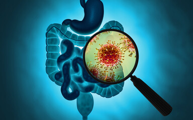 Virus or bacteria infected human digestive system. 3d illustration