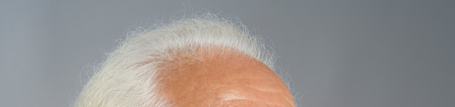 view of a senior old man top of the head  