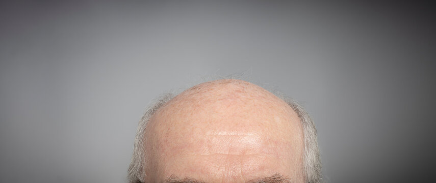 view of a senior old man top of the head  