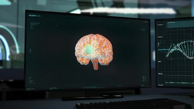 Interface of the diagnostic system used at the hospital. Interface of the diagnostic tech is studying the brain. Interface of the diagnostic software detecting deadly brain tumor. Health Care Facility