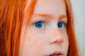 A 4-5 year old girl with bright red hair, red eyebrows, freckles and blue eyes