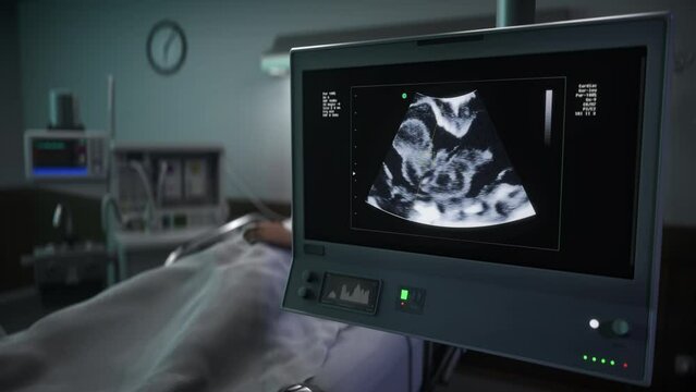 Ultrasound diagnostic analysis of the pregnant female at the hospital. Ultrasound diagnostic analysis of the child inside the womb. Ultrasound diagnostic analysis system checking the baby heartbeat.