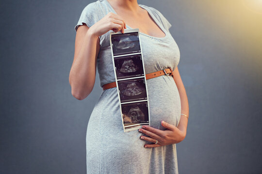 Mother, pregnant and stomach ultrasound in studio for maternity shoot, album and baby shower. Woman, expecting and sonogram isolated on gray background for gender reveal, surrogacy and legal adoption