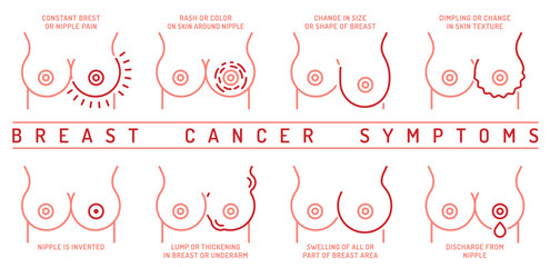 Breast carcinoma, adenocarcinoma symptoms. Malignant breast growth signs. - 788100755