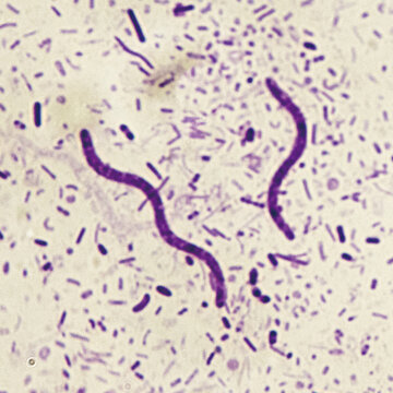 Crimson red spirochetes is a spiral shaped bacterium that is Gram negative and generally undergoes anaerobic phototrophic living.Magnify 1000x