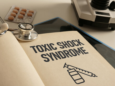 Toxic Shock Syndrome TSS diagnosis is shown using the text