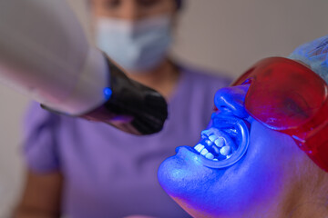Dentist whitening his patient's teeth with a blue light