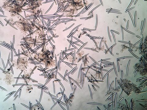 Spicules in porifera is the structure that supports porifera's body, mainly composed of silica.