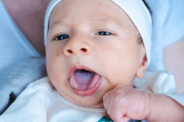 The newborn has thrush on his tongue. Baby diseases. Baby care. Thrush, a fungal infection that occurs in the mouth or on the tongue surface, is a disease caused by a fungus called Candida Albicans.