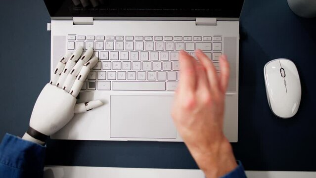 Man With Prosthetic Hand Working On Laptop