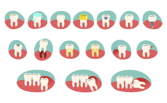 Teeth collection 2 cute on a white background, vector illustration.