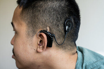 Side profile portrait of a Gen Z guy with a cochlear implant